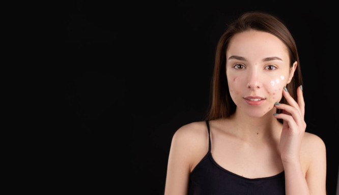 Schluss Mit Hautunreinheiten So Sagen Sie Pickeln Und Co Den Kampf An 